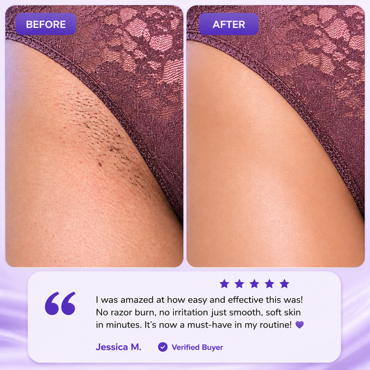Velluta Hair Removal Spray