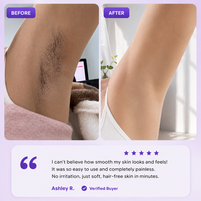 Velluta Hair Removal Spray